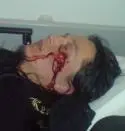 Pain - 00f69978d00f3b7ca3.jpg